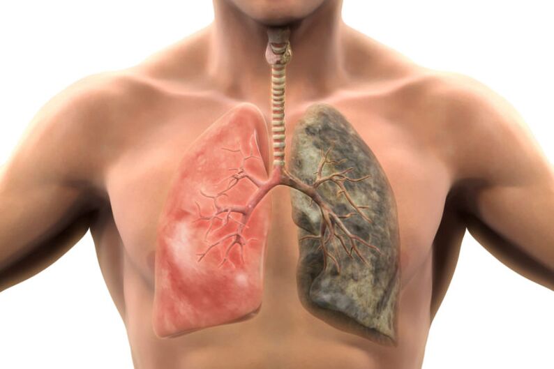 More than 200 compounds are harmful to the body's poisoning with each bulging